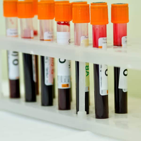 FETAL BLOOD ISSUES