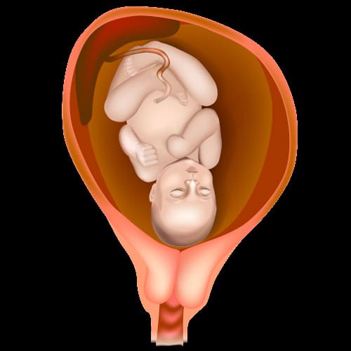 CERVICAL ABNORMALITY ISSUES