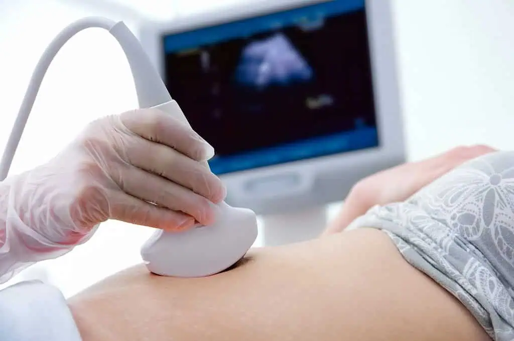Ultrasound of the abdomen for pregnancy or gynecological evaluation.